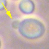 Escherichia Coli เชื้ออีโคไล การแพร่กระจายของเชื้ออีโคไล O157:H7