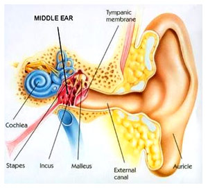 โรคน้ำในหูไม่เท่ากัน โรคแรงดันน้ำในช่องหูชั้นในผิดปกติ