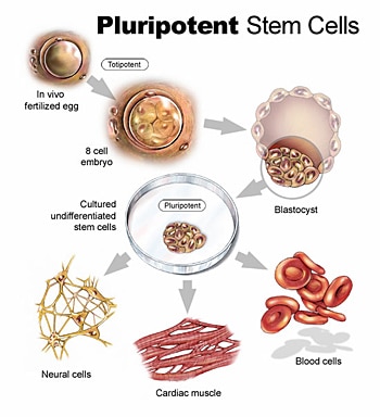 stem cell การรักษาโรคที่ไม่มีทางรักษาให้หายขาดได้ด้วย เซลล์ต้นกำเนิด